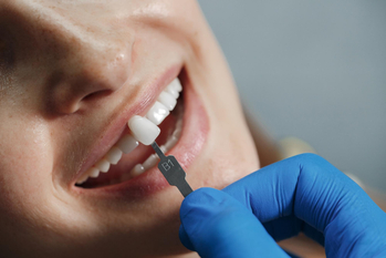 A dentist fitting porcelain veneers for a patient in a modern dental clinic in Colombia, showcasing affordable and high-quality dental care